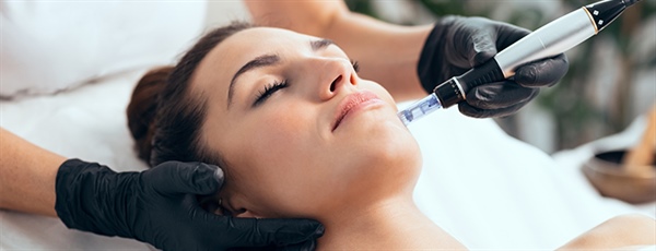 The Hidden Secrets of Radiant Skin Through Microneedling RF