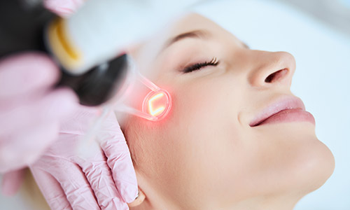 Erbium Skin Resurfacing Laser 