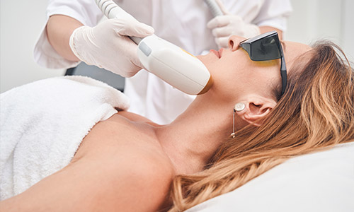 Intense Pulsed Light (IPL) 